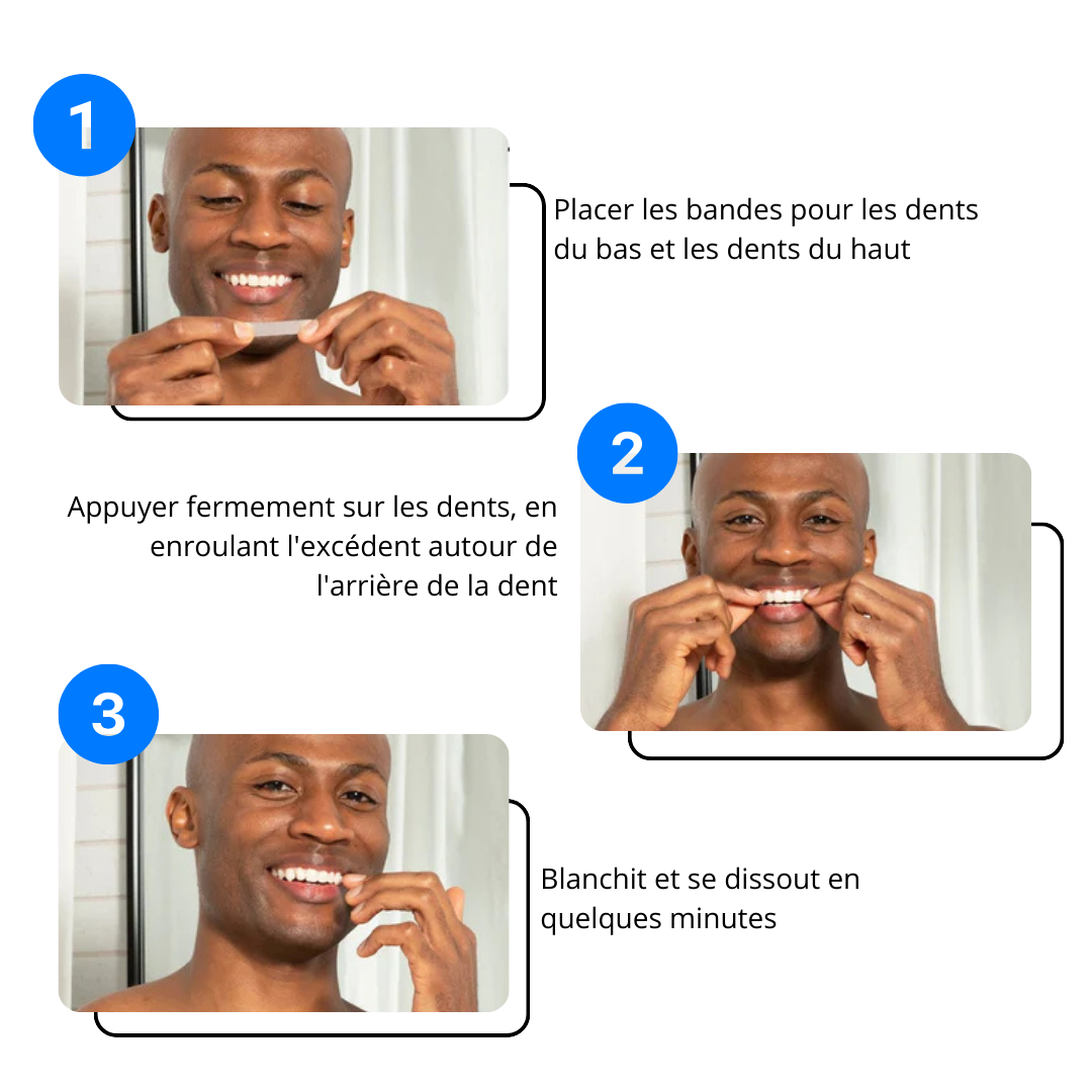 Whitening Strips - Sou'rire™