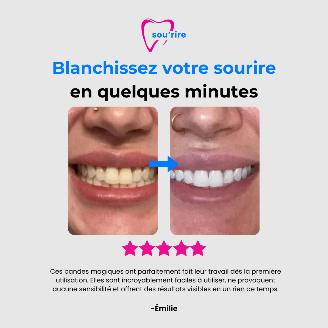 Whitening Strips - Sou'rire™