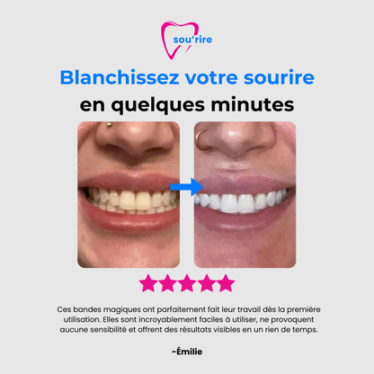 Whitening Strips - Sou'rire™